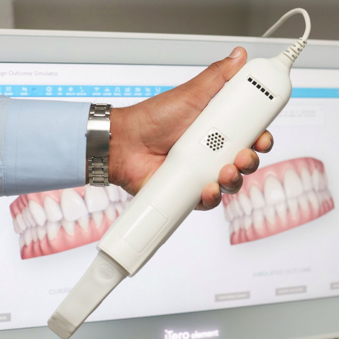 Ennis and Limerick Braces - Smile Scanning